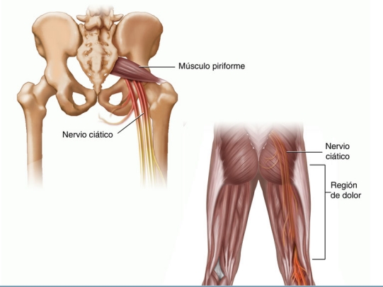 atrofia muscular