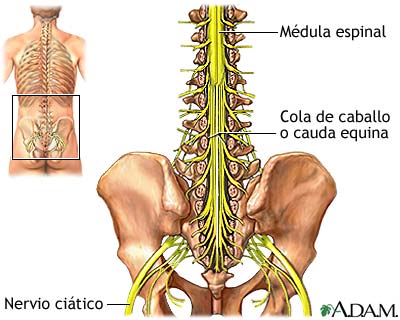trauma.raquimedular