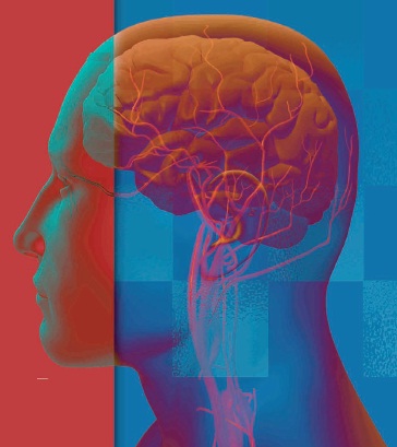 enfermedad-cerebrovascular