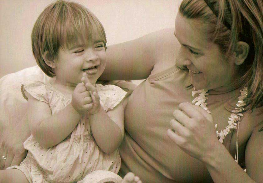 sindrome-de-down