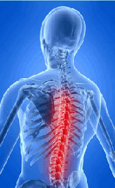 Vivir con Esclerosis Múltiple sin perder el sentido del humor