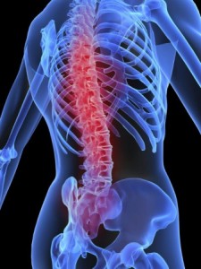 Osteoporosis guía de práctica clínica