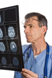 Accidente cerebro vascular guía de prevención