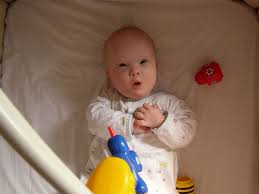 Alimentacion del bebe con Sindrome de Down
