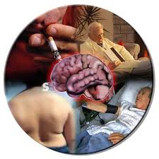 Enfermedad cerebrovascular plan de cuidados para el paciente