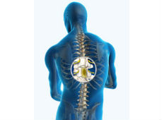 Espasticidad en lesiones de medula espinal