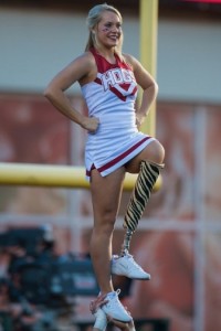 Historia de Patience Beard la porrista con pierna ortopedica