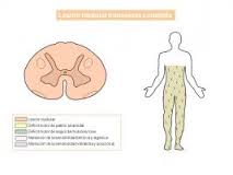 Lesion medular traumatica e incontinencia urinaria