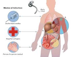 Virus del Ebola transmision y sintomas