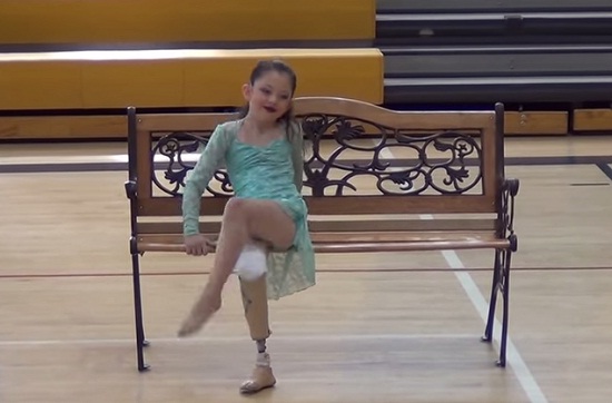 Bailarina amputada de 8 años conmueve en recital de danza