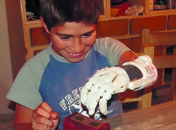 Niño recibio mano creada con impresora 3D